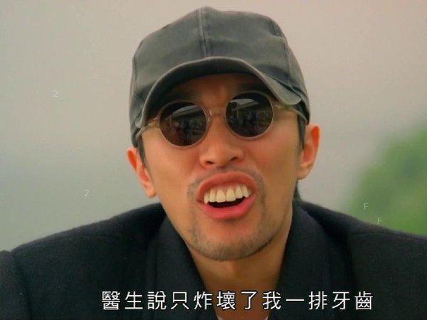 teeth-whitening-9.jpg