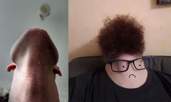 beardchin_feature_2928636605ae19d8b5b8de.jpg