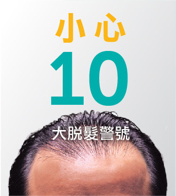 10_hairloss_signals.jpg